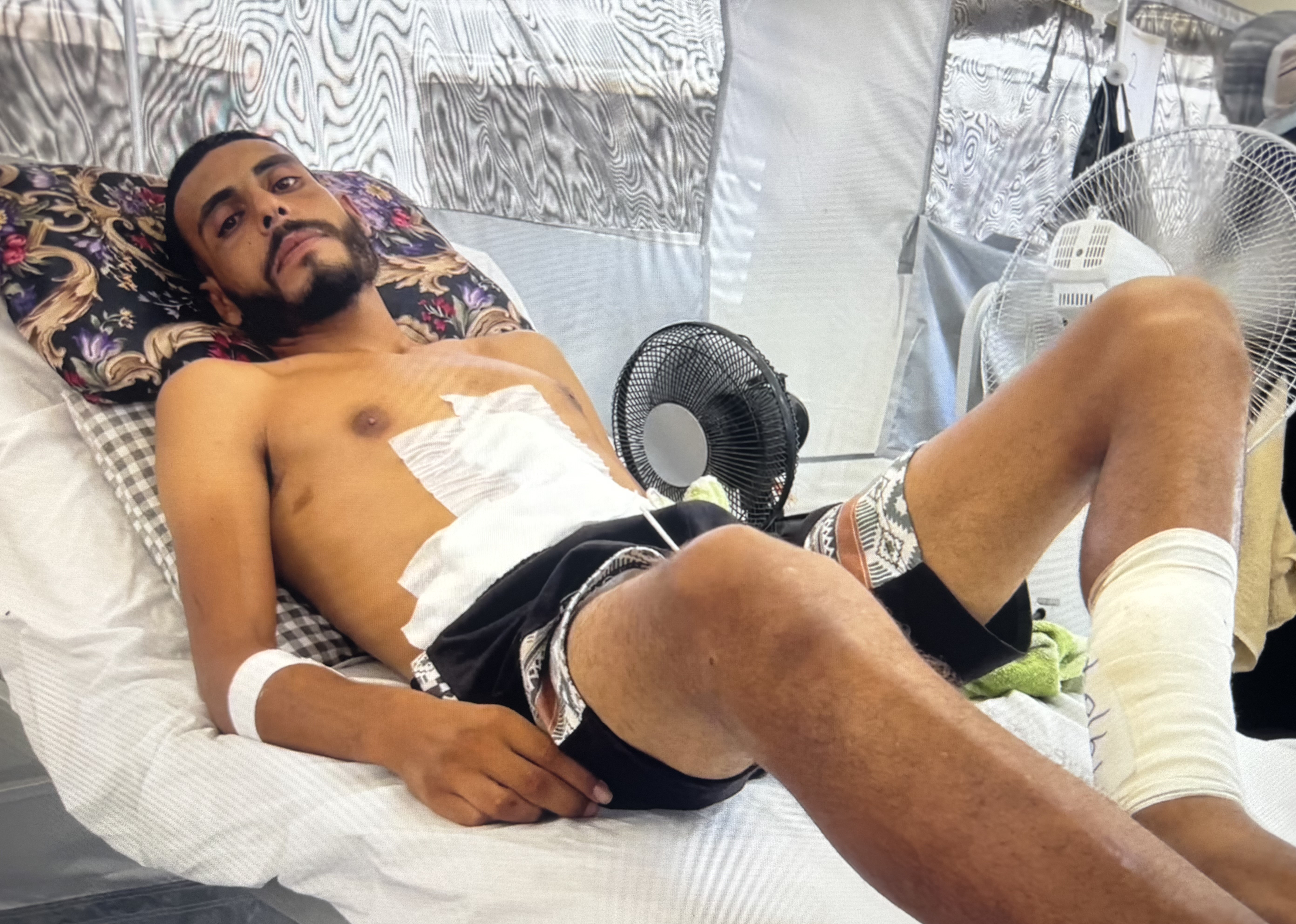 Ein Mann mit Verbänden am Bauch, Arm und Bein liegt auf einem Bett im Feldkrankenhaus des Roten Kreuzes in Rafah.