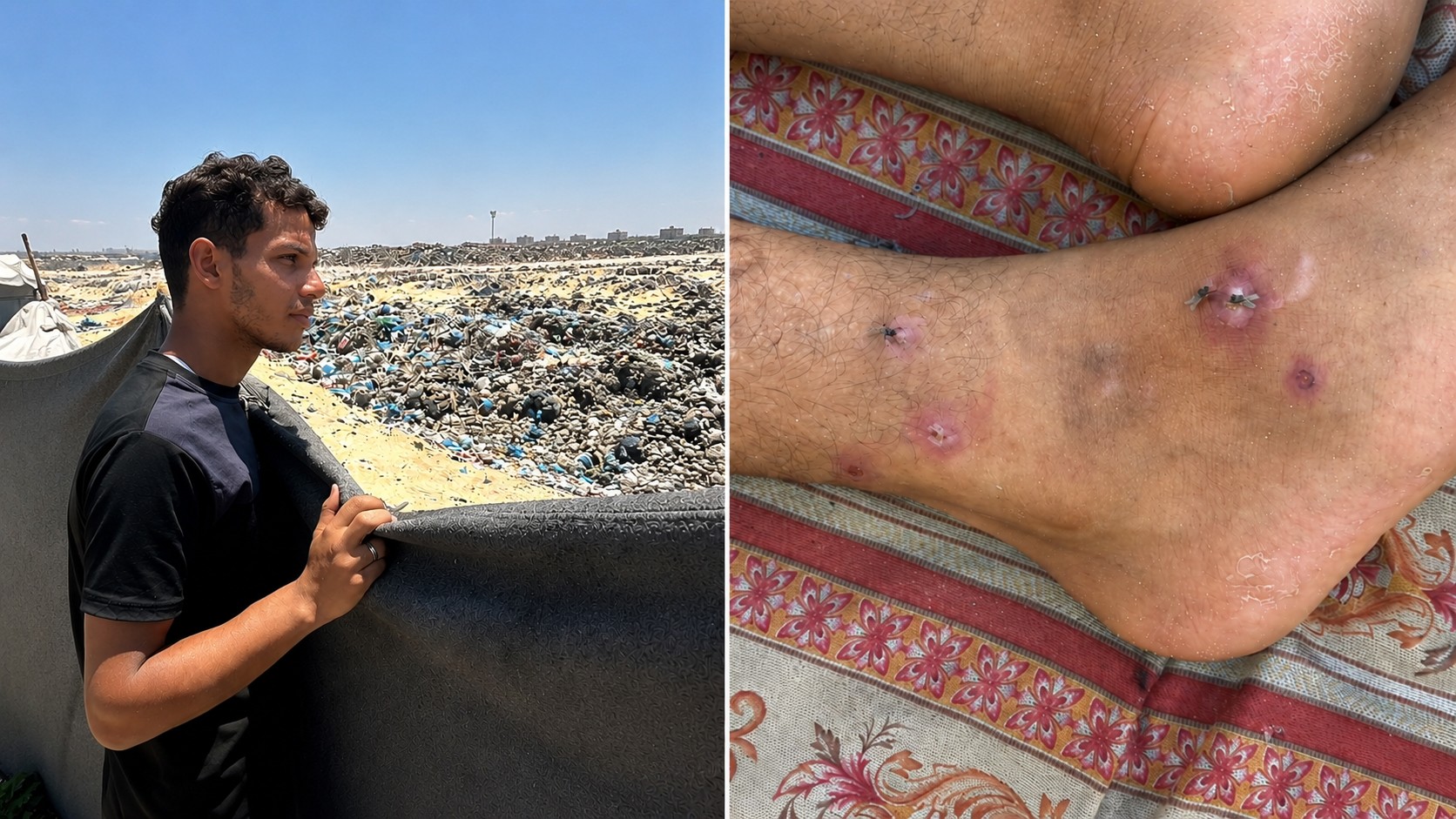صورة مركبة لقدم وشاب يمسك بساتر من القماش وعلى مرمى البصر نفايات ملقاة.