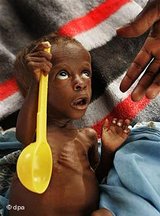Stark unterernährtes afrikanisches Kind im Niger; Foto: AP