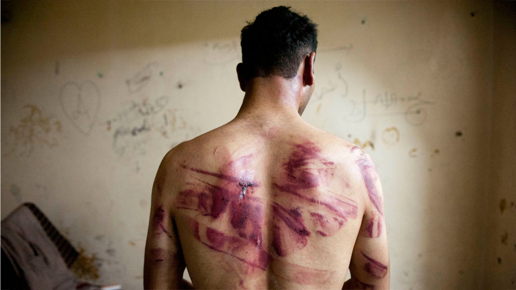 Folteropfer aus Aleppo; Foto: Getty Images/AFP/J. Lawler