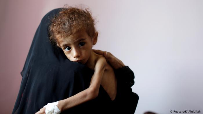 لقطات من كفاح اليمنيين من أجل الحياة في ظل الفقر والحرب والوباء - اليمن