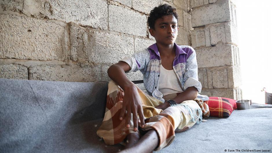 Save the Children press photo | Yemen war: this boy was seriously injured in two air strikes (photo: Save the Children/Sami Jassar)