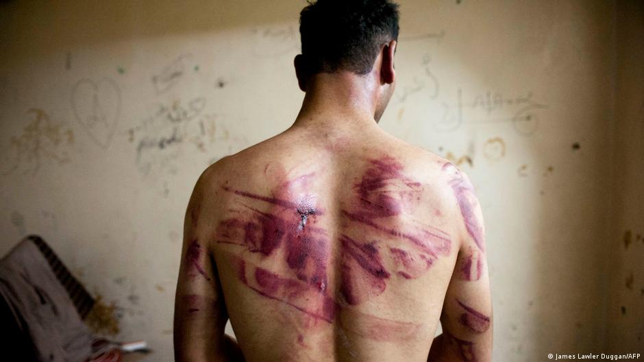 مع الاحتجاجات ضد نظام بشار الأسد، تحولت السجون السورية إلى مكان لارتكاب الفظائع من تعذيب وبث الرعب بل والقتل. 