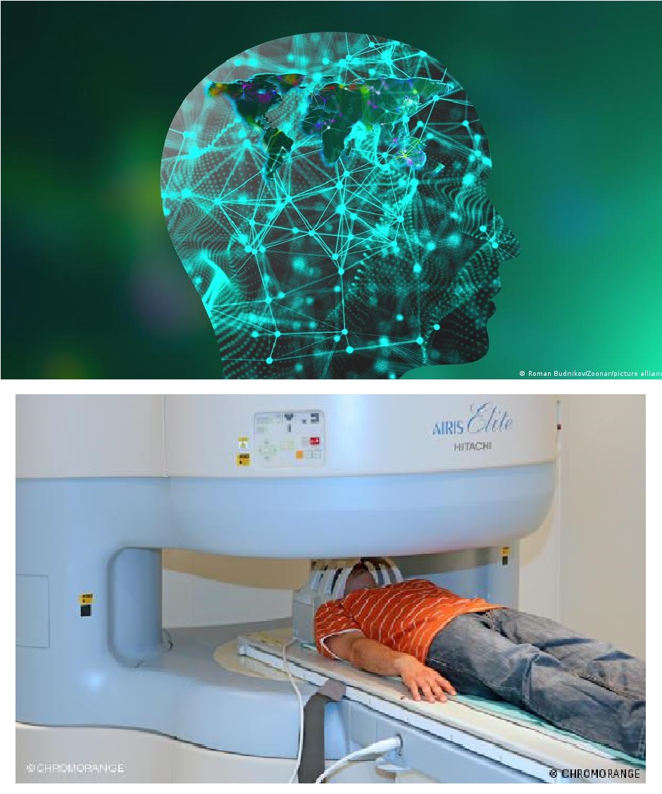 Magnetic resonance imaging (MRI) scans provide high-resolution images of the brain (image: picture-alliance and Chromorange)