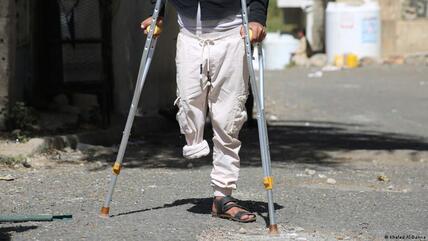 أحد ضحايا انفجار الالغام في اليمن - في تعز.