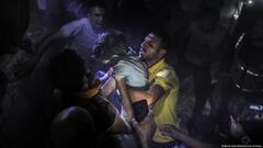 أب يحمل طفلته الجريحة في غزة 